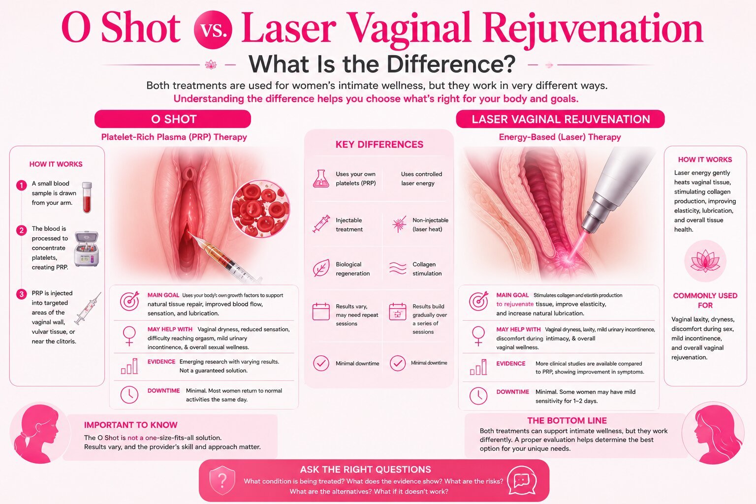 O Shot vs Laser Vaginal Rejuvenation differences and comparison